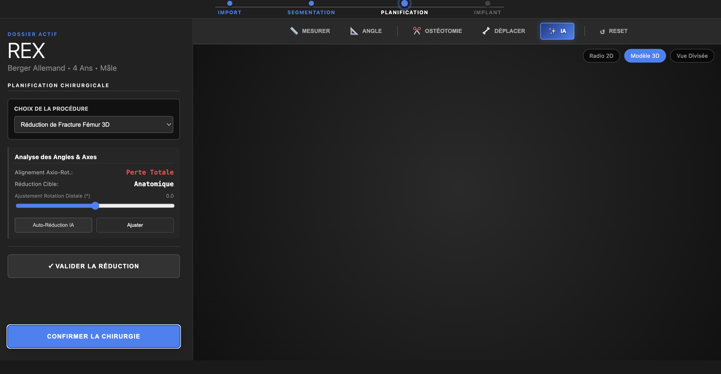 Interface OSTEON — vue 2