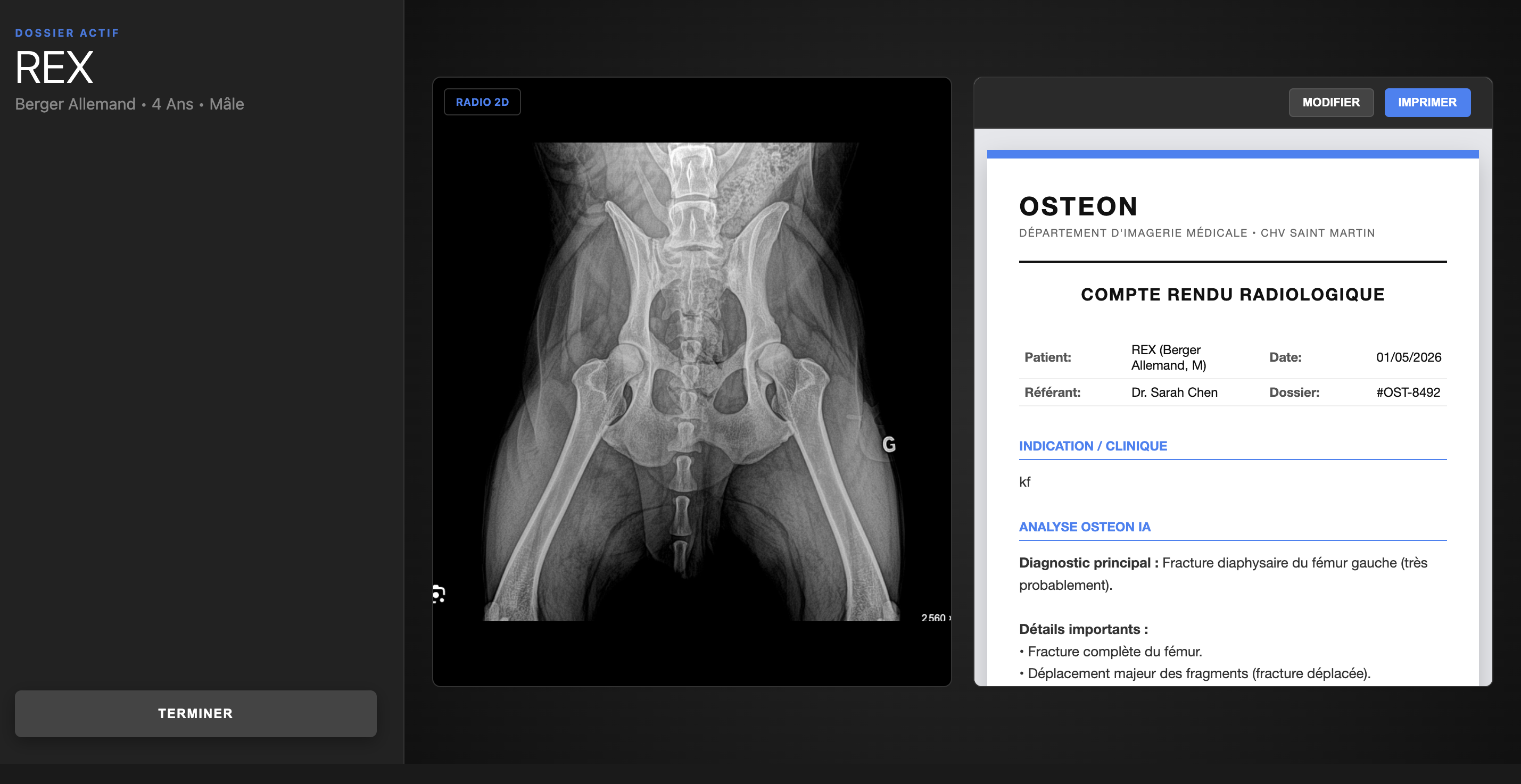 Interface OSTEON — vue 3